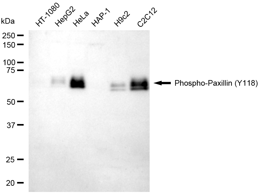 [KD Validated] Anti-PXN Rabbit mAb [54P86S13]
