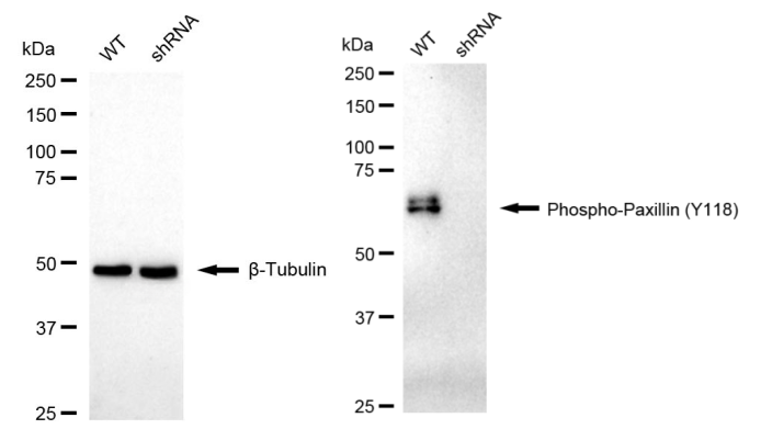 [KD Validated] Anti-PXN Rabbit mAb [54P86S13]