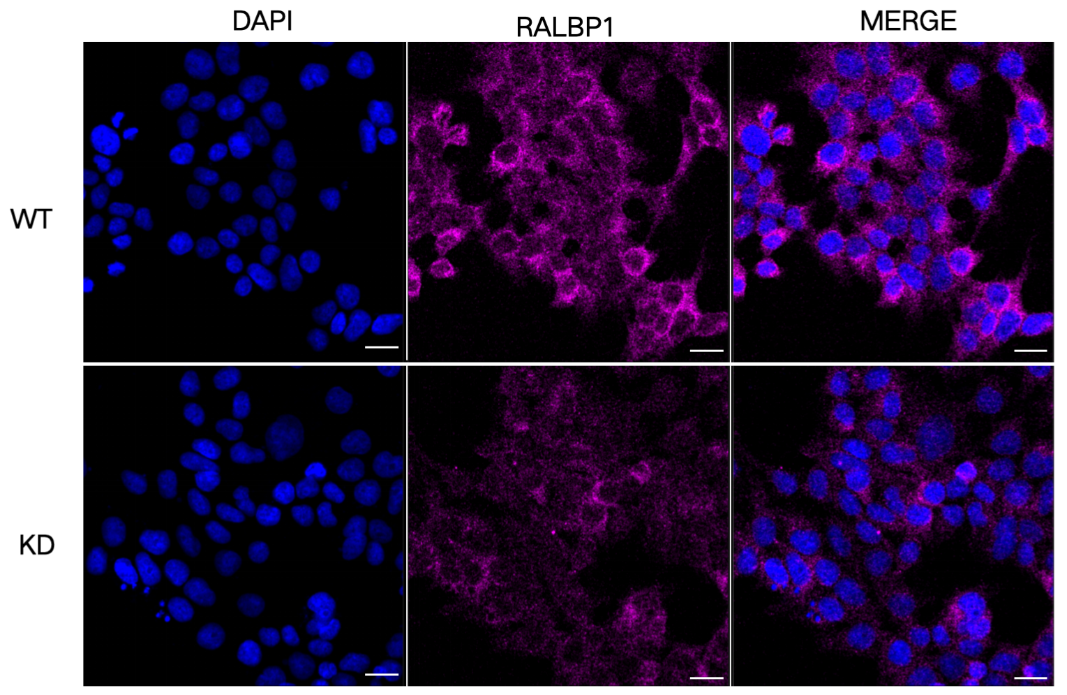 [KD Validated] Anti-RALBP1 Rabbit mAb [56N94H21]