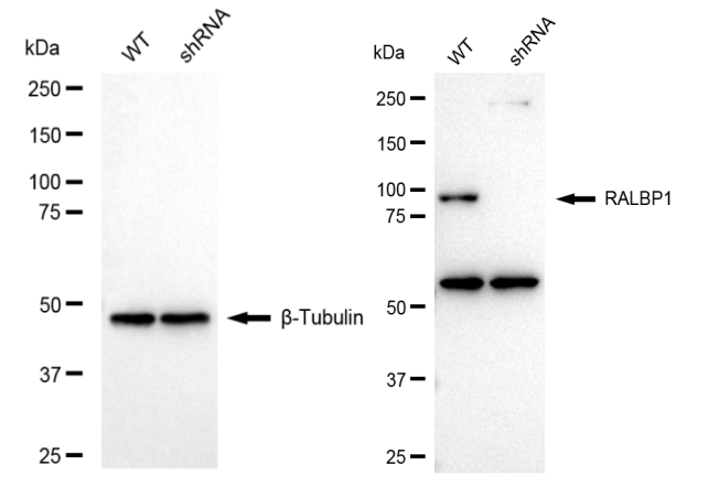 [KD Validated] Anti-RALBP1 Rabbit mAb [56N94H21]