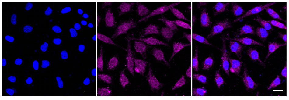 [KD Validated] Anti-PRMT5 Rabbit mAb [96A59L29]