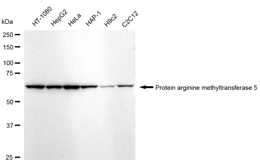 [KD Validated] Anti-PRMT5 Rabbit mAb [96A59L29]