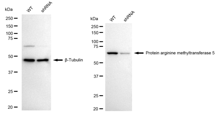 [KD Validated] Anti-PRMT5 Rabbit mAb [96A59L29]