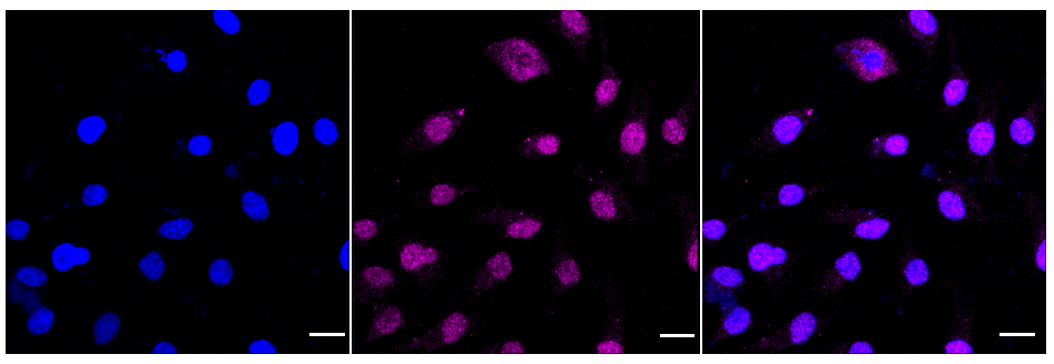 [KD Validated] Anti-PSIP1 Rabbit mAb [84B60L54]