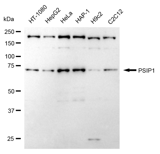 [KD Validated] Anti-PSIP1 Rabbit mAb [84B60L54]