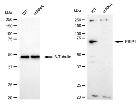 [KD Validated] Anti-PSIP1 Rabbit mAb [84B60L54]
