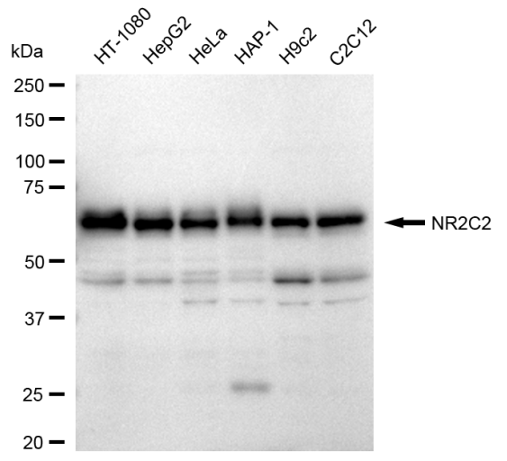 [KD Validated] Anti-NR2C2 Rabbit mAb [55B65Q86]