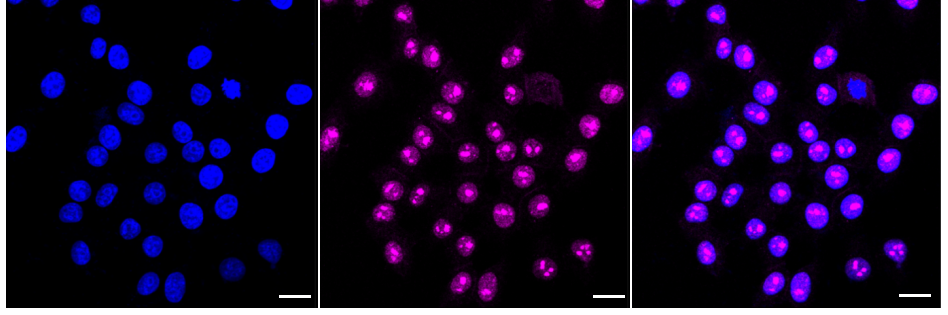 [KD Validated] Anti-LYN Rabbit mAb [64R85N39]