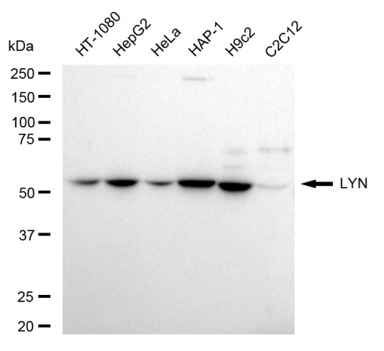 [KD Validated] Anti-LYN Rabbit mAb [64R85N39]