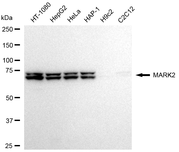 [KD Validated] Anti-MARK2 Rabbit mAb [69R85P77]
