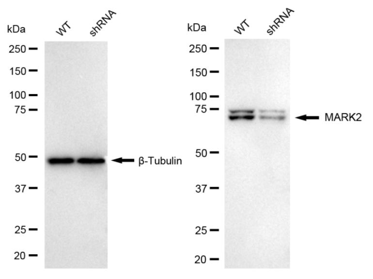 [KD Validated] Anti-MARK2 Rabbit mAb [69R85P77]