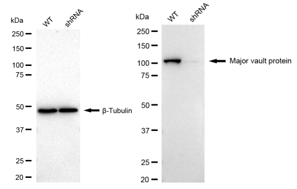 [KD Validated] Anti-MVP Rabbit mAb [43S87M42]