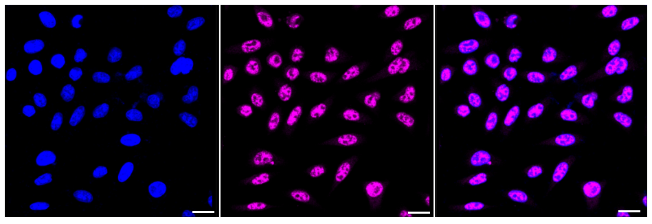 [KD Validated] Anti-PABPN1 Rabbit mAb [34M86B17]