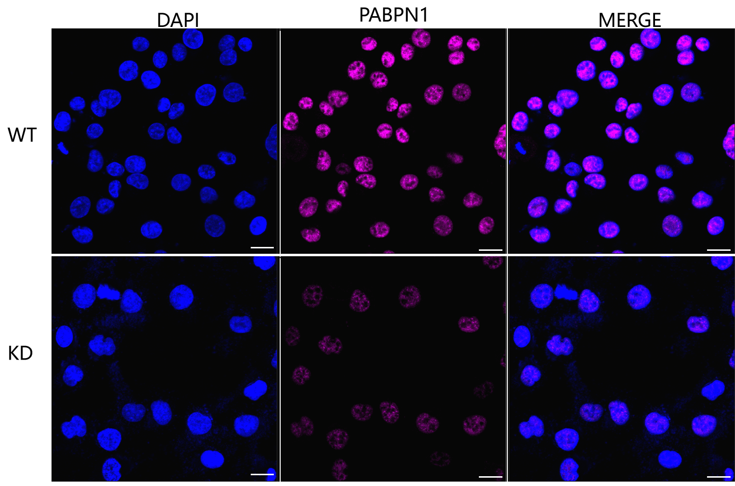 [KD Validated] Anti-PABPN1 Rabbit mAb [34M86B17]