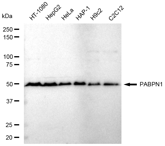 [KD Validated] Anti-PABPN1 Rabbit mAb [34M86B17]