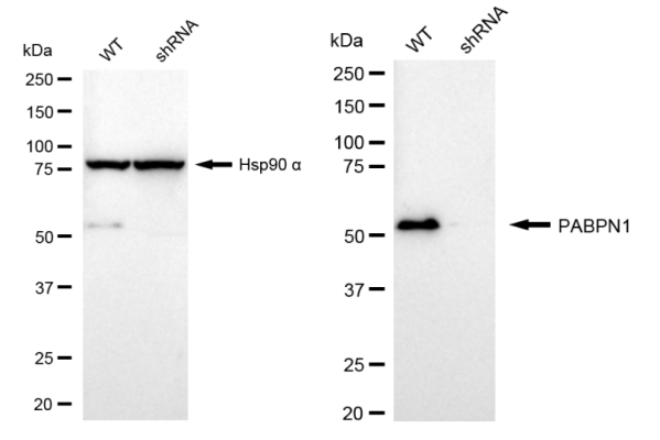 [KD Validated] Anti-PABPN1 Rabbit mAb [34M86B17]