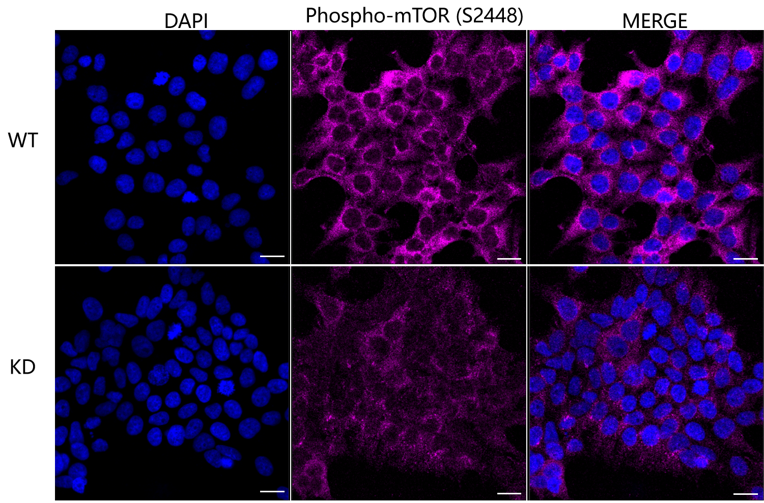 [KD Validated] Anti-MTOR Rabbit mAb [77C89N02]