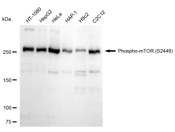 [KD Validated] Anti-MTOR Rabbit mAb [77C89N02]