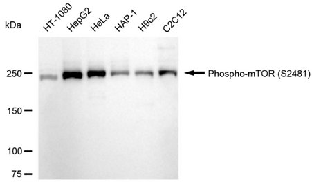 [KD Validated] Anti-MTOR Rabbit mAb [29L04Q66]