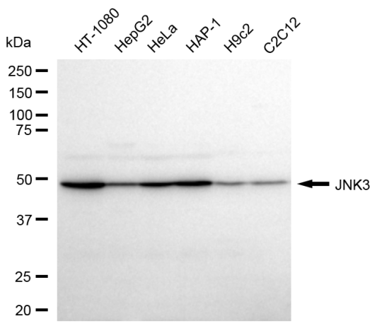 [KD Validated] Anti-MAPK10 Rabbit mAb [60P37R49]