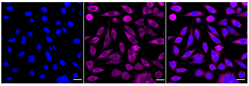 [KD Validated] Anti-MAP3K2 Rabbit mAb [10C40E93]