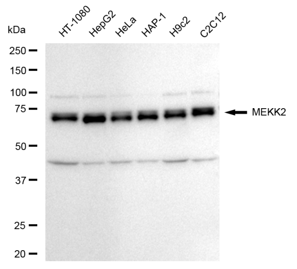 [KD Validated] Anti-MAP3K2 Rabbit mAb [10C40E93]