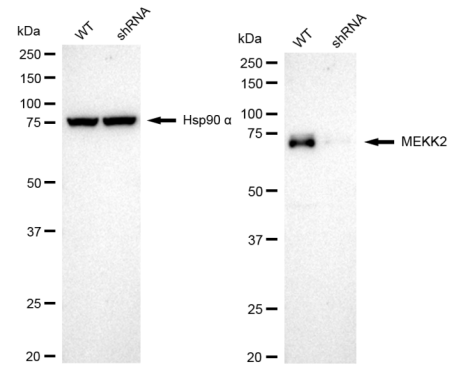 [KD Validated] Anti-MAP3K2 Rabbit mAb [10C40E93]