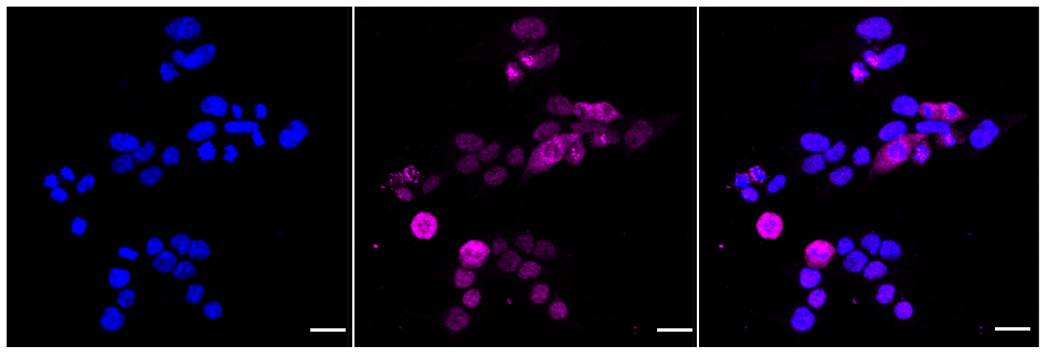 [KD Validated] Anti-MYD88 Rabbit mAb [94T79D17]
