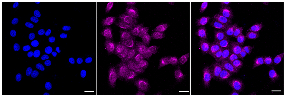 [KD Validated] Anti-MTOR Rabbit mAb [90Q34D27]