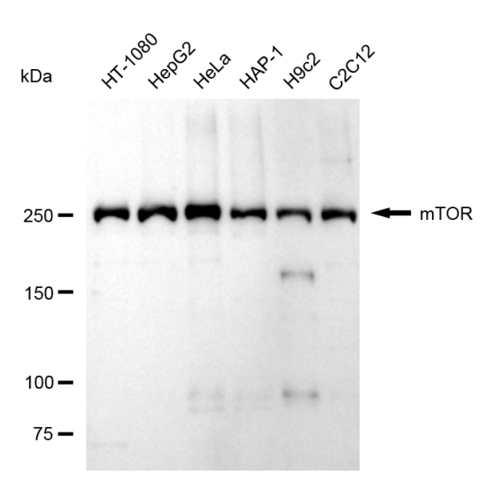 [KD Validated] Anti-MTOR Rabbit mAb [90Q34D27]