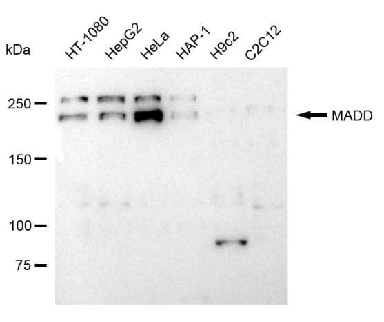 [KD Validated] Anti-MADD Rabbit mAb [68Q61R91]