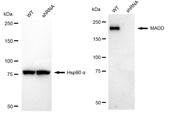 [KD Validated] Anti-MADD Rabbit mAb [68Q61R91]