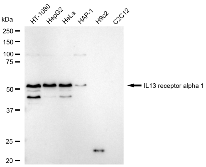[KD Validated] Anti-IL13RA1 Rabbit mAb [55H40C93]