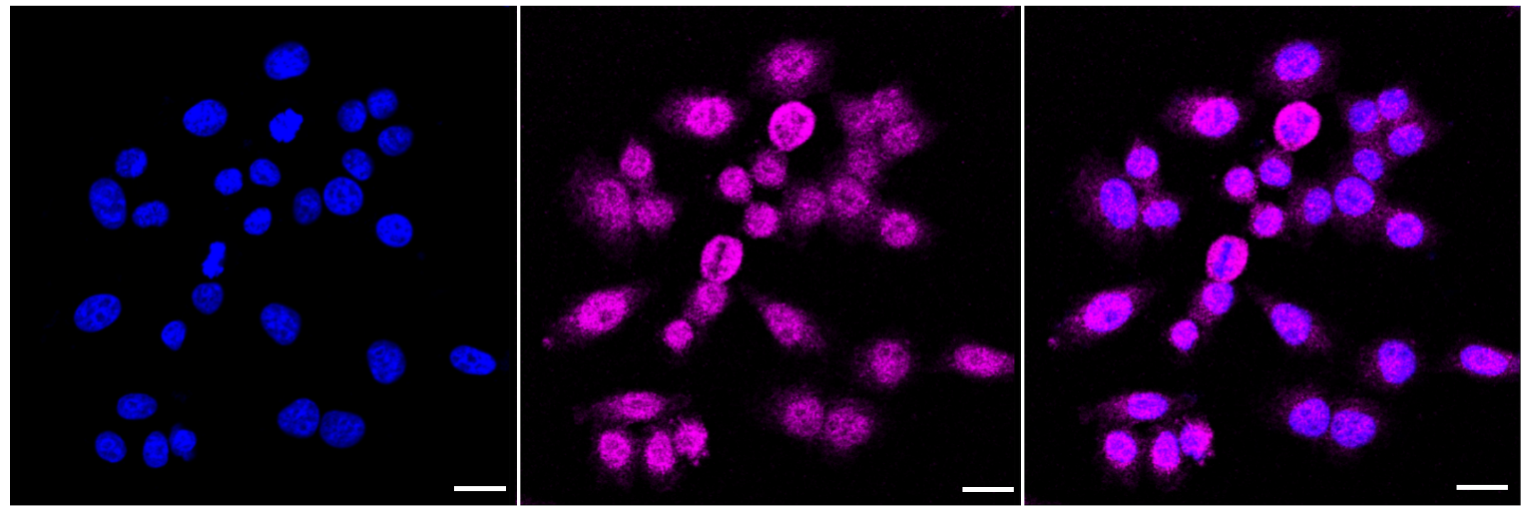 [KD Validated] Anti-EEF2 Rabbit mAb [11T98H86]