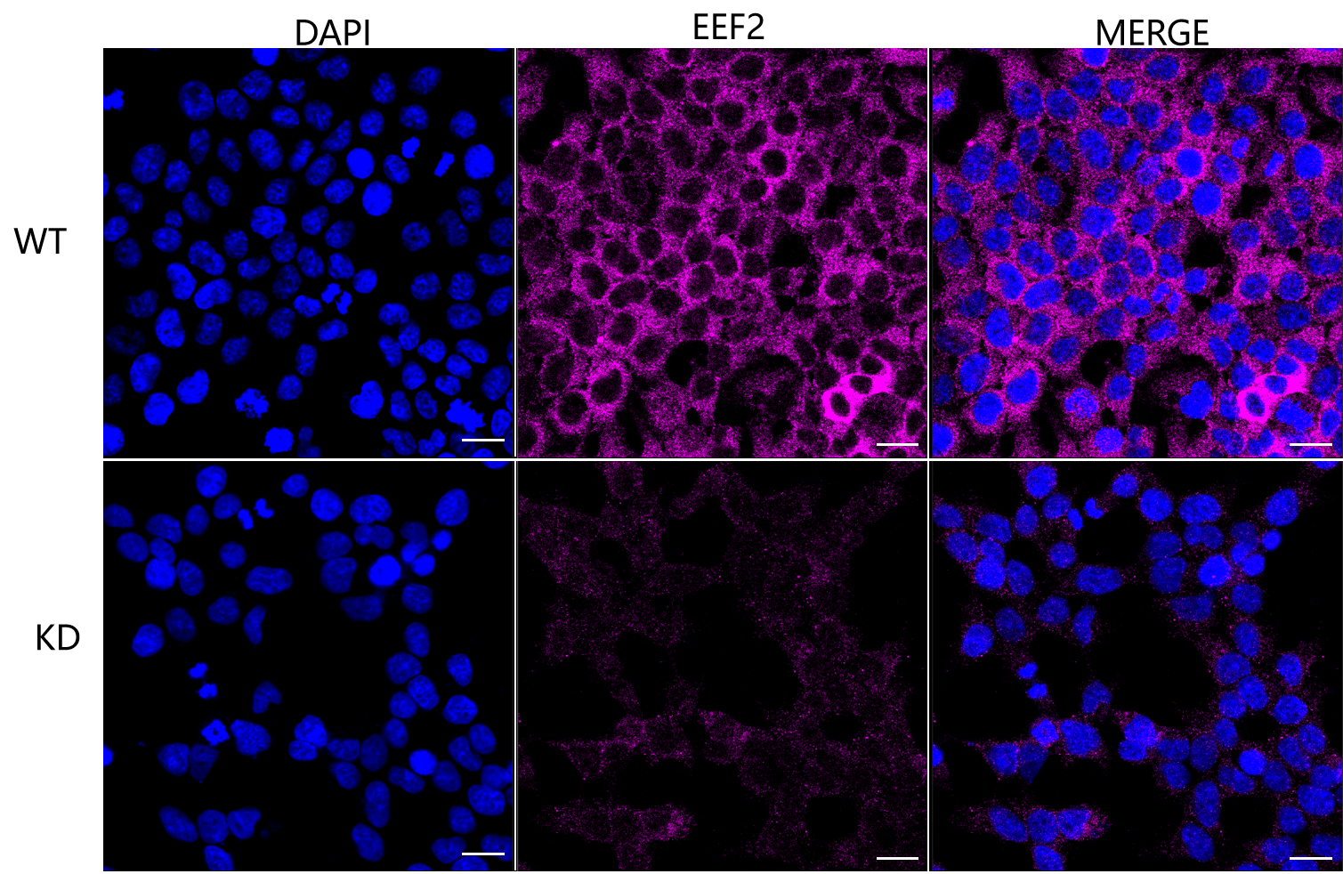 [KD Validated] Anti-EEF2 Rabbit mAb [11T98H86]