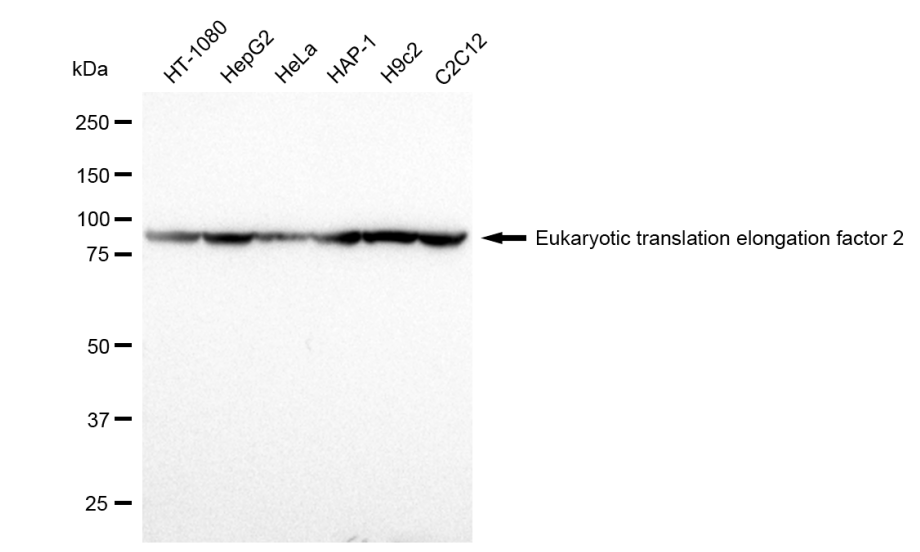 [KD Validated] Anti-EEF2 Rabbit mAb [11T98H86]