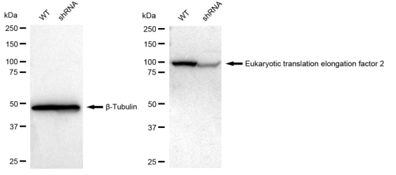 [KD Validated] Anti-EEF2 Rabbit mAb [11T98H86]