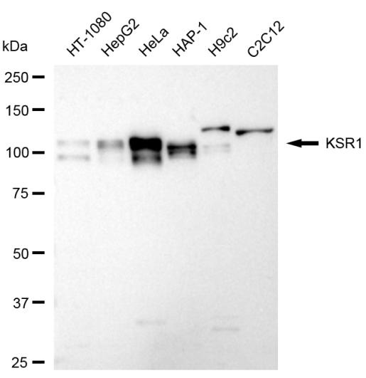 [KD Validated] Anti-KSR1 Rabbit mAb [10F41G01]