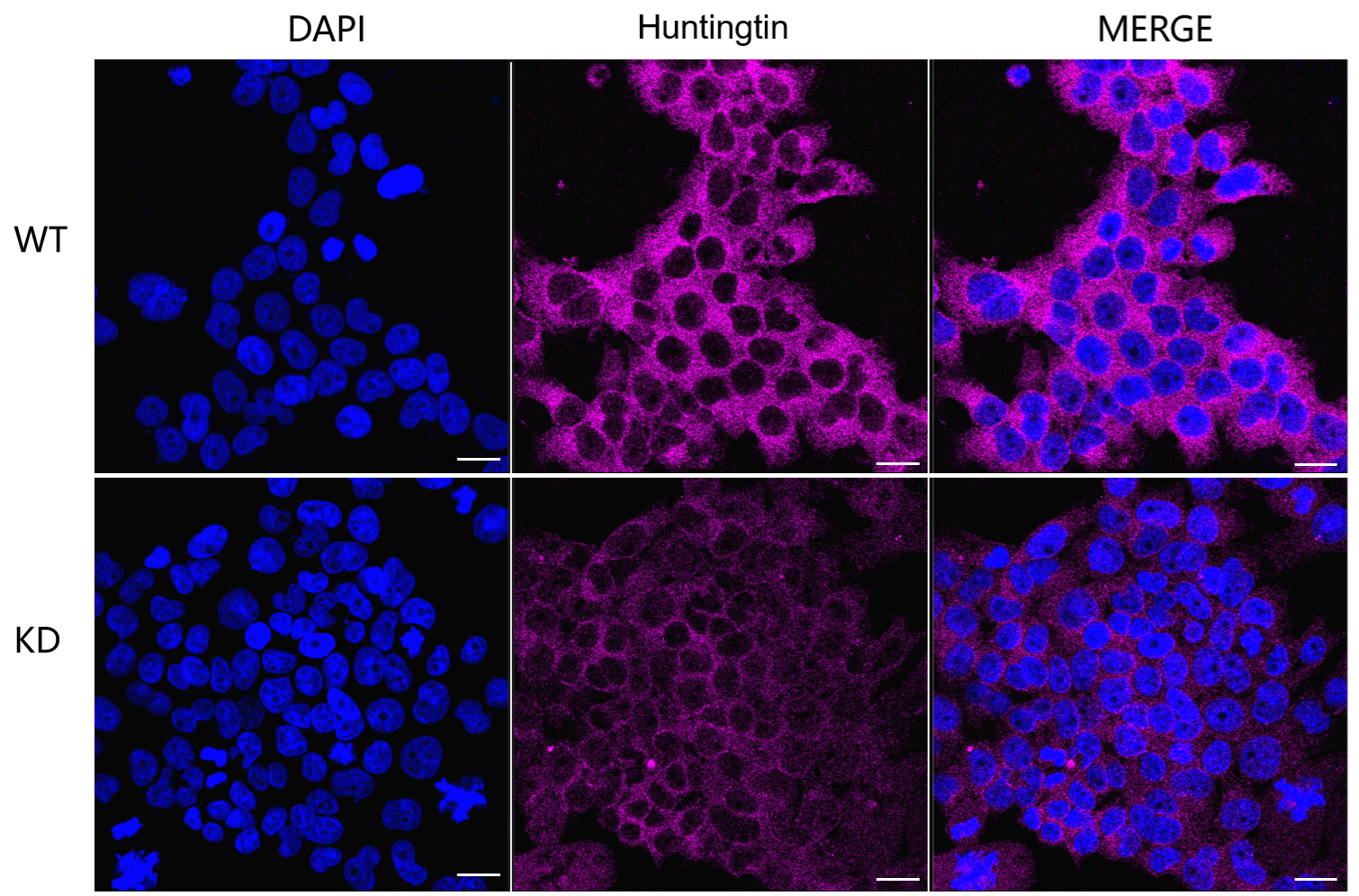 [KD Validated] Anti-HTT Rabbit mAb [24D84P30]