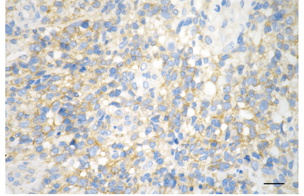 [KD Validated] Anti-HTT Rabbit mAb [24D84P30]