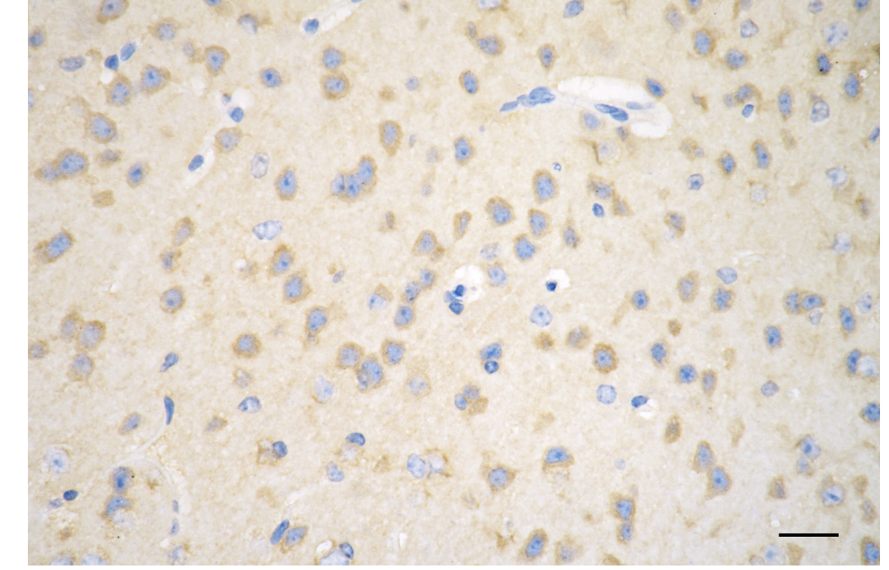 [KD Validated] Anti-HTT Rabbit mAb [24D84P30]