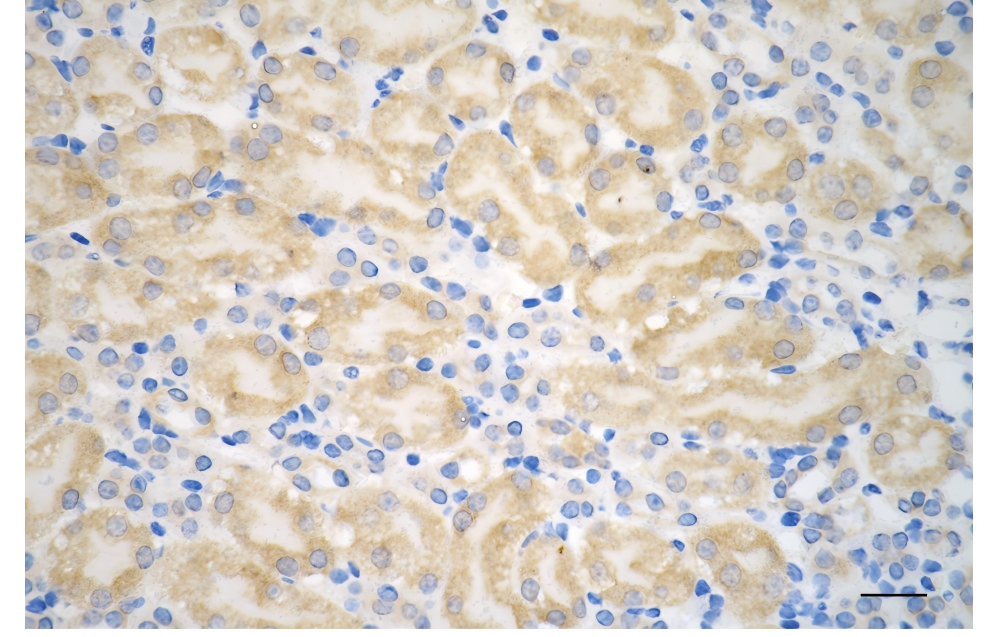 [KD Validated] Anti-HTT Rabbit mAb [24D84P30]