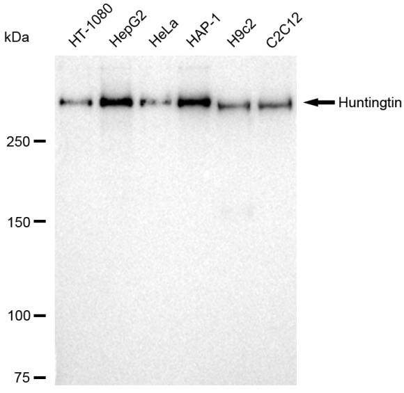 [KD Validated] Anti-HTT Rabbit mAb [24D84P30]