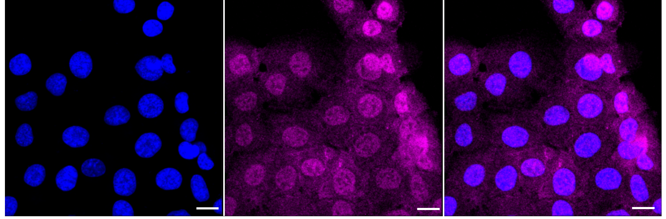 [KD Validated] Anti-GRB2 Rabbit mAb [53C94R30]