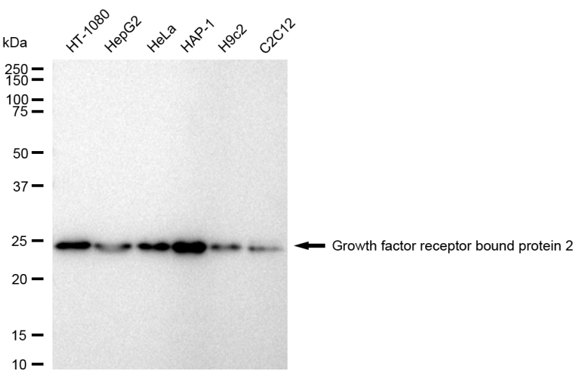 [KD Validated] Anti-GRB2 Rabbit mAb [53C94R30]