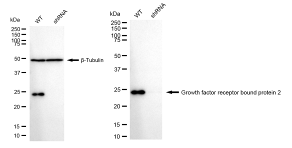[KD Validated] Anti-GRB2 Rabbit mAb [53C94R30]