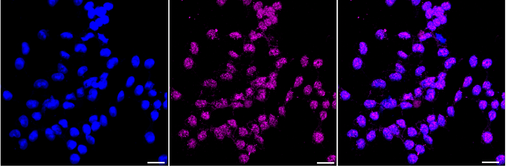 [KD Validated] Anti-GTF2I Rabbit mAb [69E66F85]