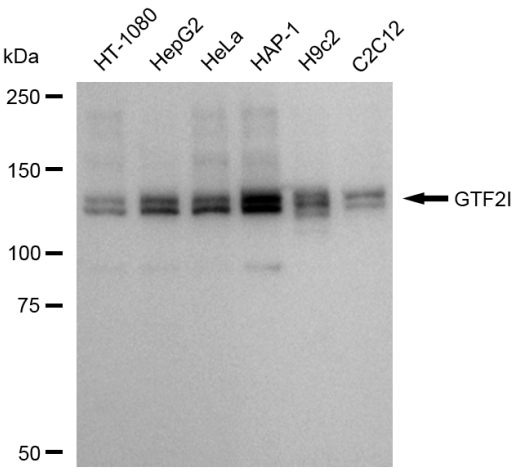 [KD Validated] Anti-GTF2I Rabbit mAb [69E66F85]