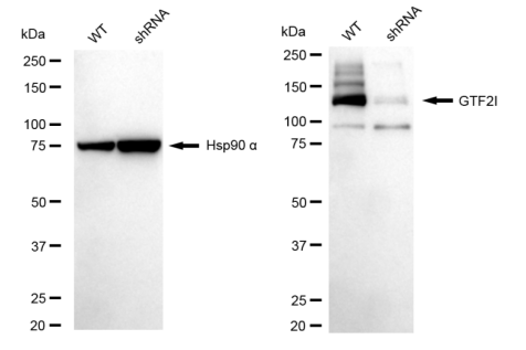 [KD Validated] Anti-GTF2I Rabbit mAb [69E66F85]