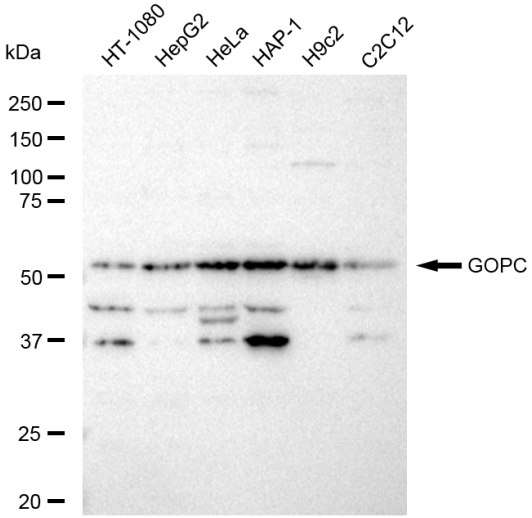 [KD Validated] Anti-GOPC Rabbit mAb [42Q12B41]